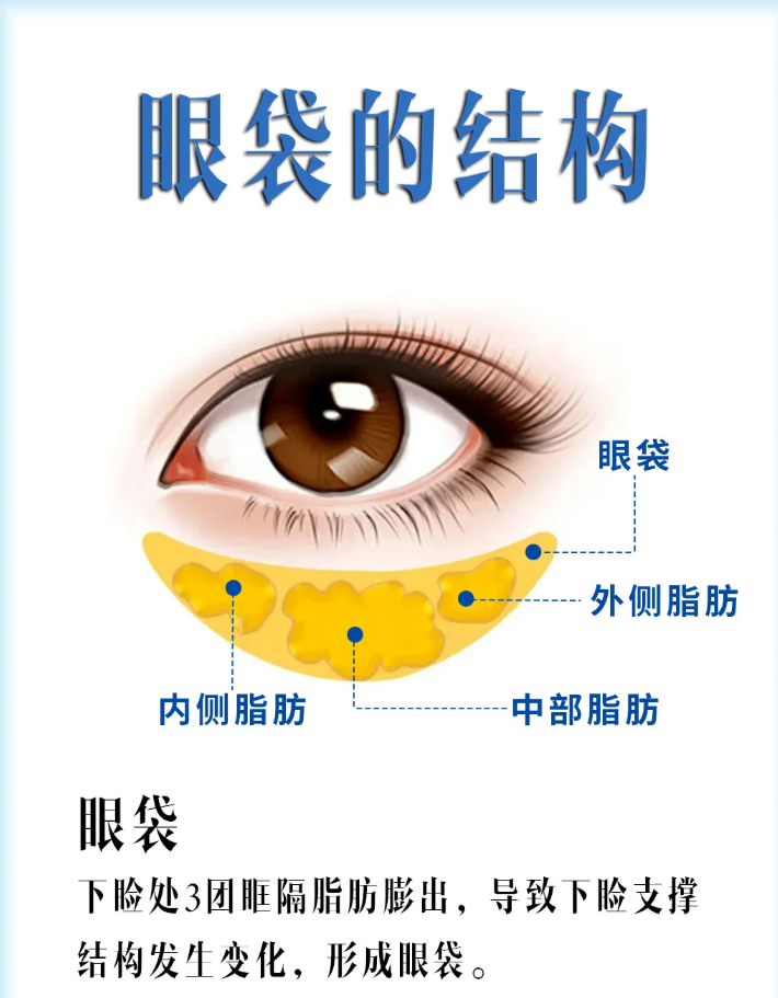 杭州翁胜涛祛眼袋技术怎么样？翁胜涛去眼袋效果好不好？翁胜涛预约电话
