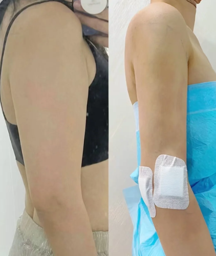 2026大连吸脂技术最好的医生康乐和郑妍丽做吸脂怎么样？