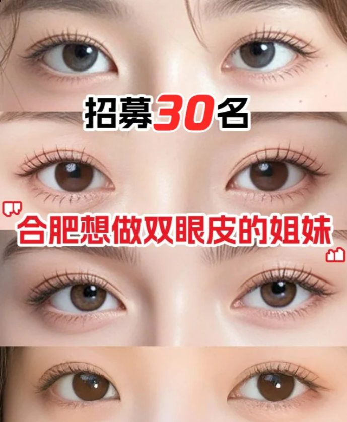 合肥双眼皮医生哪个技术好？李继银、闫品行、朱邦中、曹林、朱慧茹、李树平双眼皮谁更好？