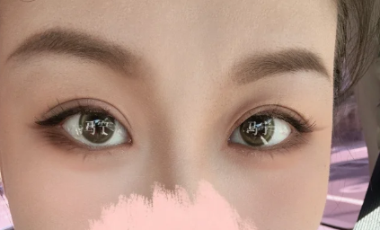 北京八大处双眼皮医生推荐哪个？马宁、梁雪冰、卢建建、李梓菲、宗宪磊、吴荣薇、宋涛、翟震、宋宇鹏、王淑杰？