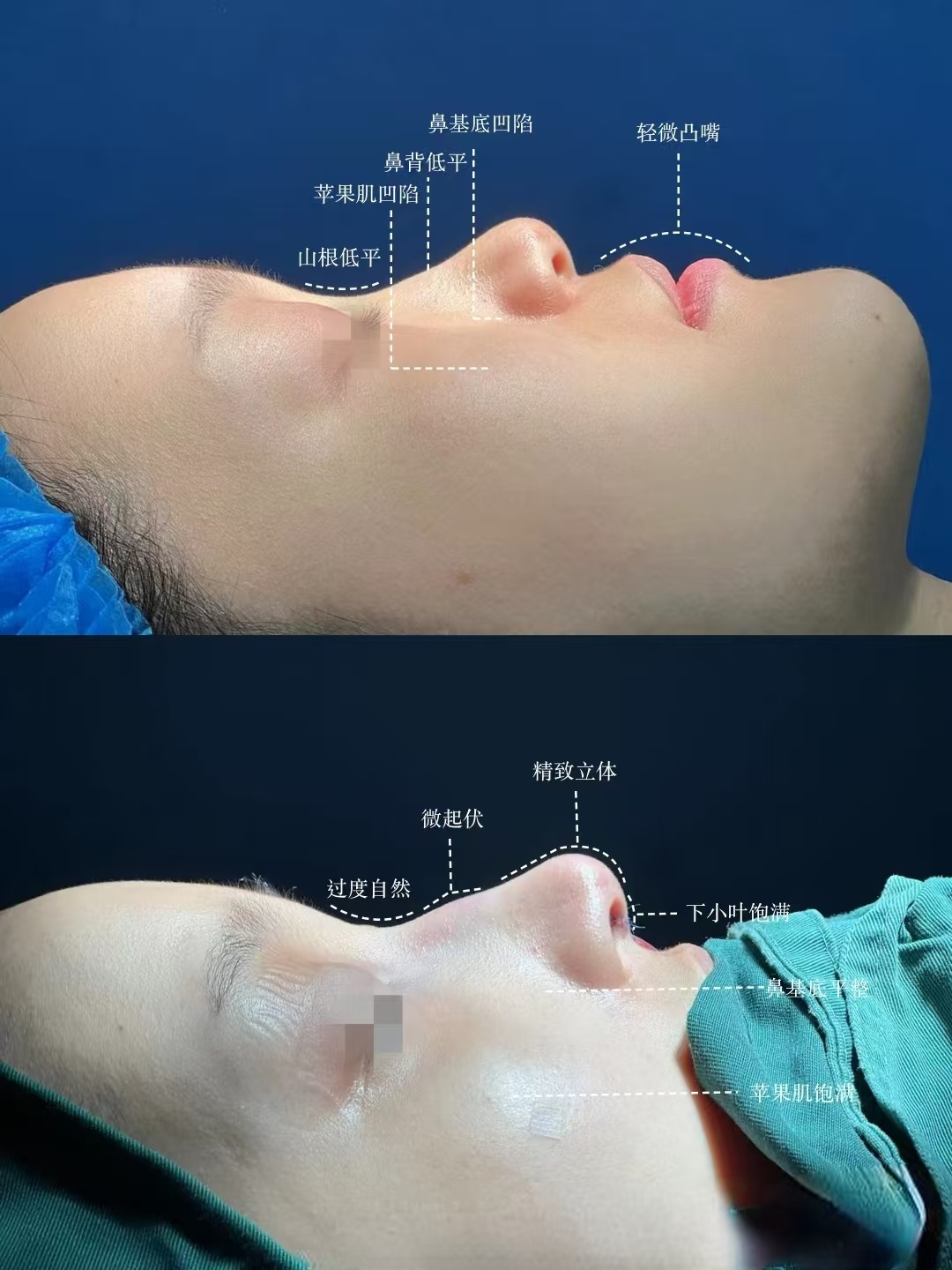 2026年上海隆鼻医生范荣杰、葛志鑫、许炎龙、曹勇、李章、李翔、范锴、魏皎、戴婷婷哪个医生技术好？