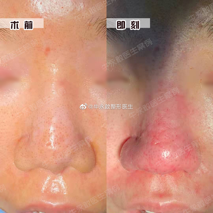 牛永敢鼻修复技术靠谱吗，价格多少？
